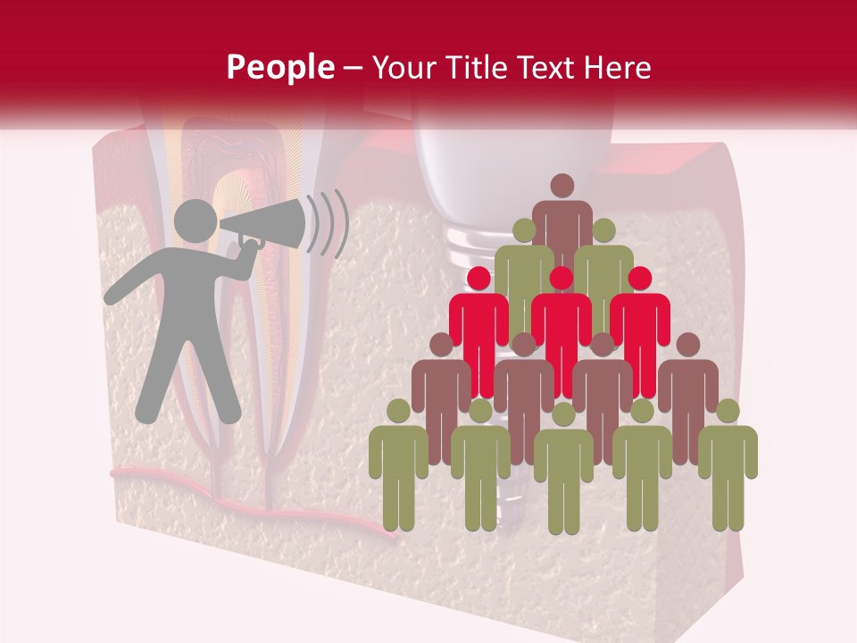 A Tooth With A Dental Implant On Top Of It PowerPoint Template