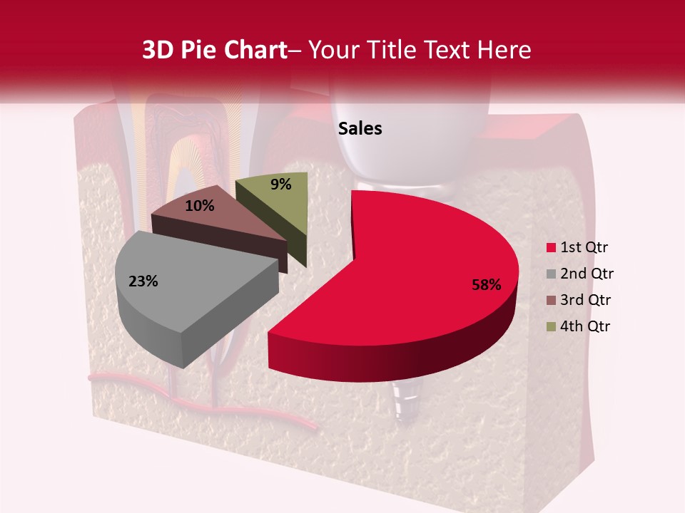 A Tooth With A Dental Implant On Top Of It PowerPoint Template