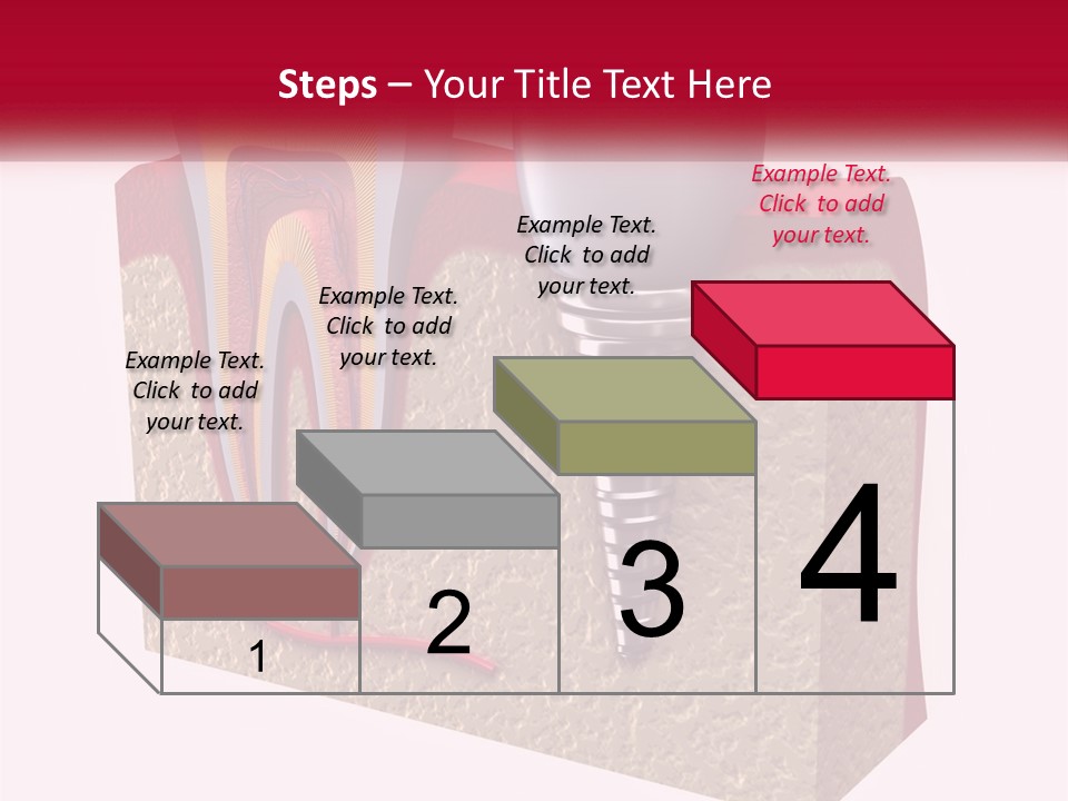 A Tooth With A Dental Implant On Top Of It PowerPoint Template