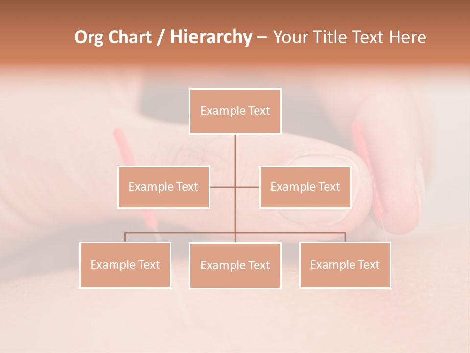 A Woman's Finger With A Needle In It PowerPoint Template