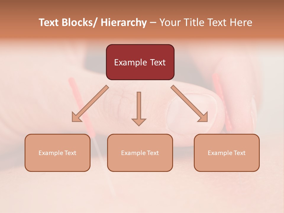 A Woman's Finger With A Needle In It PowerPoint Template