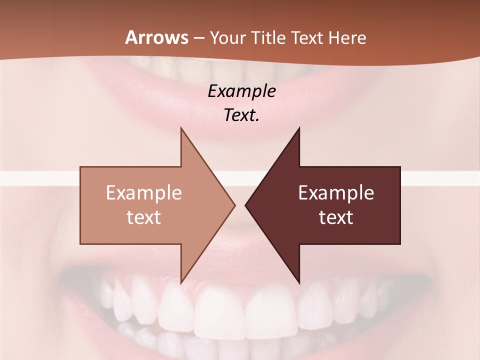 A Woman's Teeth With Whitening And Whitening On Them PowerPoint Template