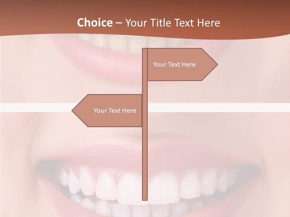 A Woman's Teeth With Whitening And Whitening On Them PowerPoint Template
