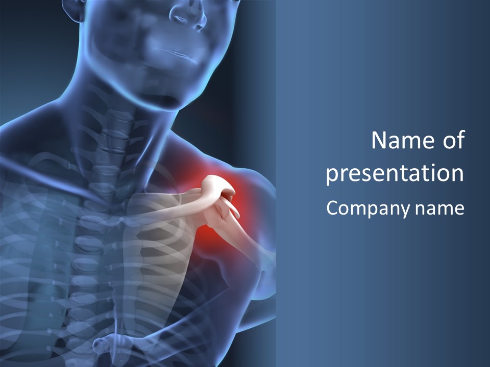 A Man Holding His Shoulder In Pain Powerpoint Presentation PowerPoint Template