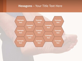 Cutout Sole Sprain PowerPoint Template