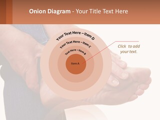 Cutout Sole Sprain PowerPoint Template