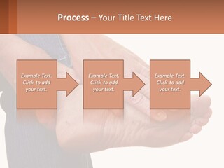 Cutout Sole Sprain PowerPoint Template