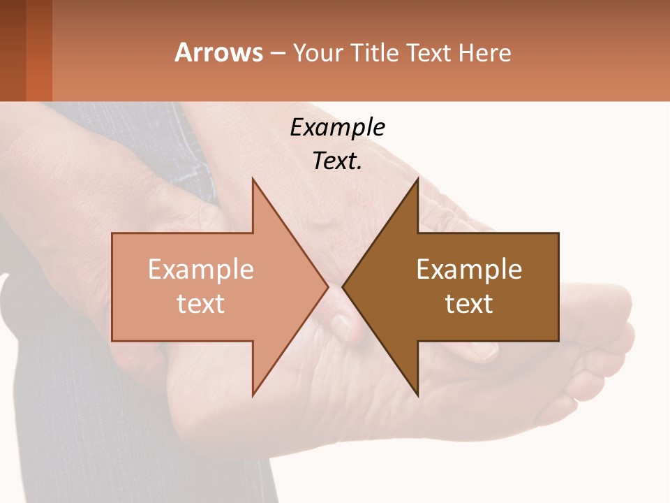 Cutout Sole Sprain PowerPoint Template