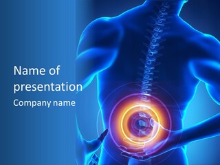 Pain Painful Study PowerPoint Template