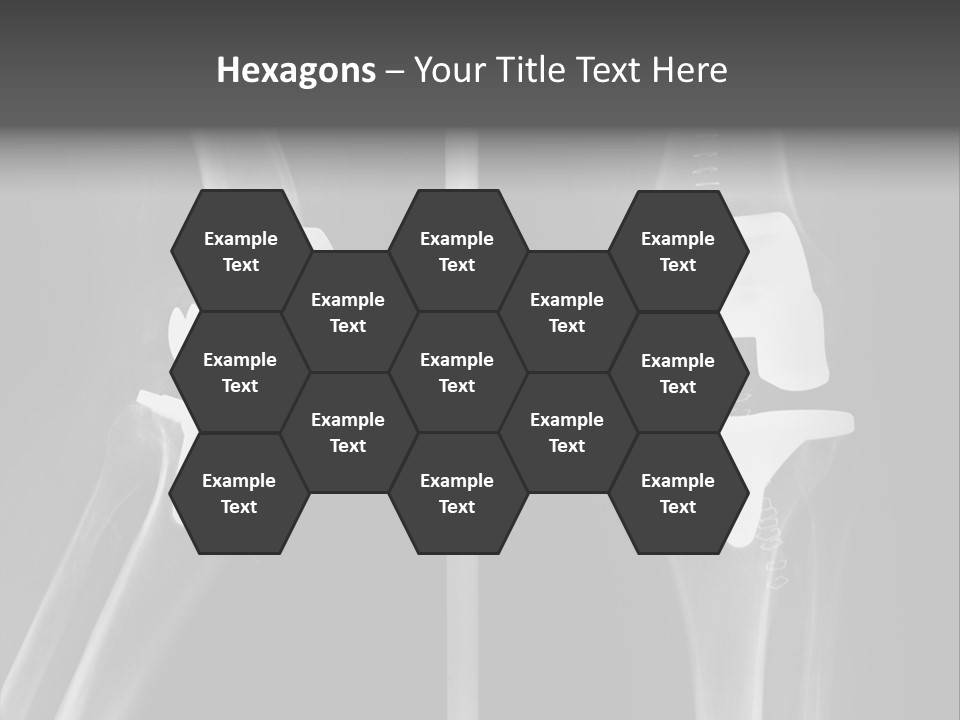 Mother Old Pensioner PowerPoint Template