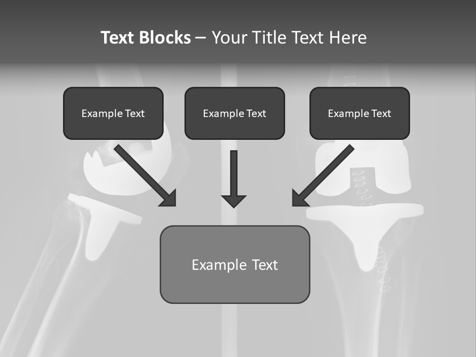 Mother Old Pensioner PowerPoint Template