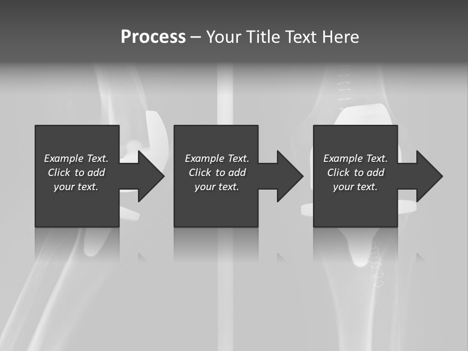 Mother Old Pensioner PowerPoint Template