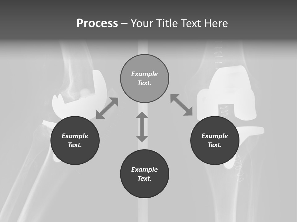 Mother Old Pensioner PowerPoint Template
