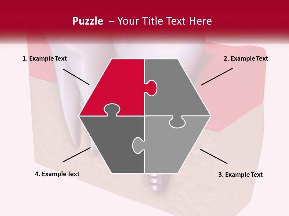 Research Technology Dentures PowerPoint Template
