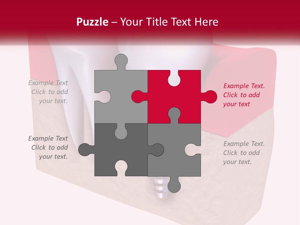 Research Technology Dentures PowerPoint Template