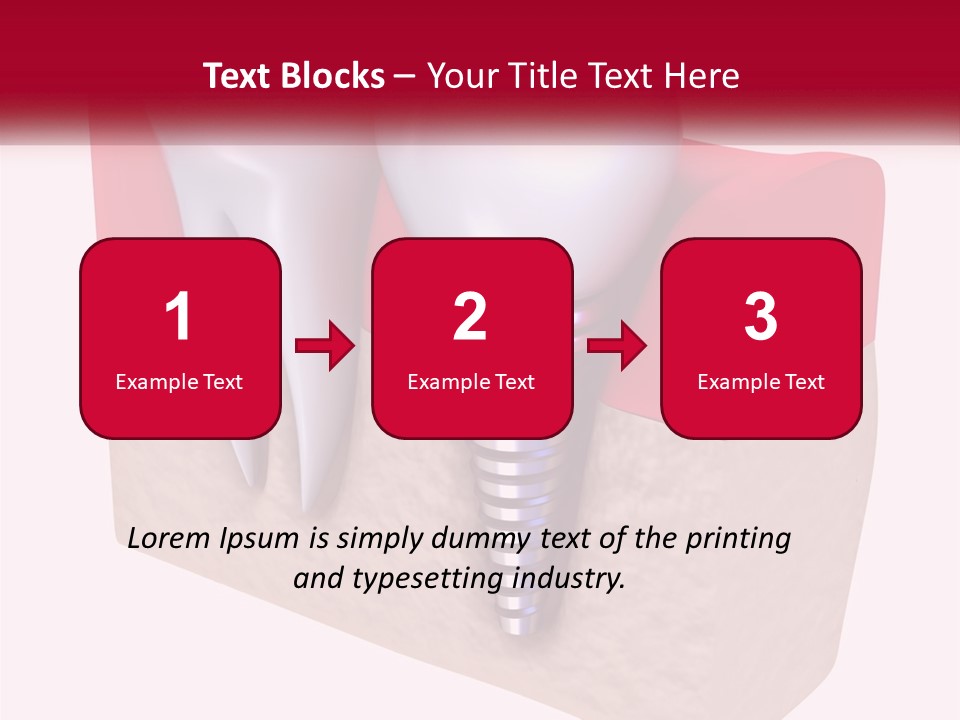 Research Technology Dentures PowerPoint Template