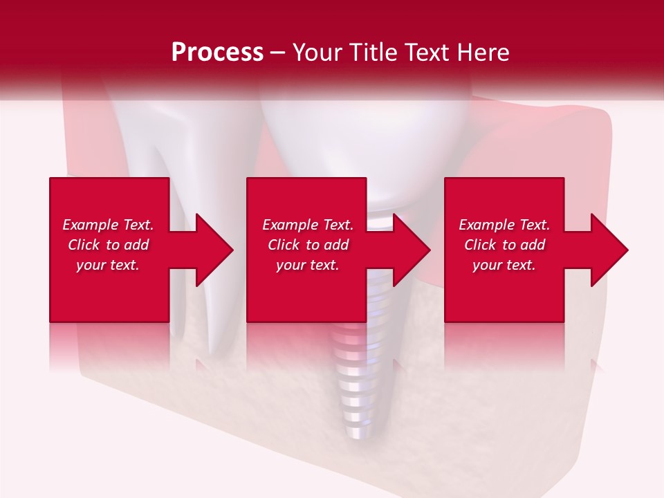 Research Technology Dentures PowerPoint Template
