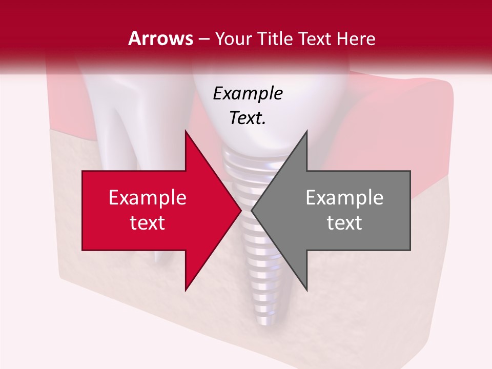 Research Technology Dentures PowerPoint Template