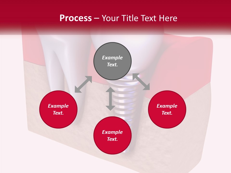 Research Technology Dentures PowerPoint Template