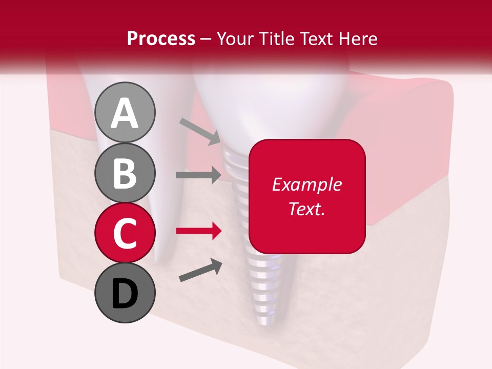 Research Technology Dentures PowerPoint Template