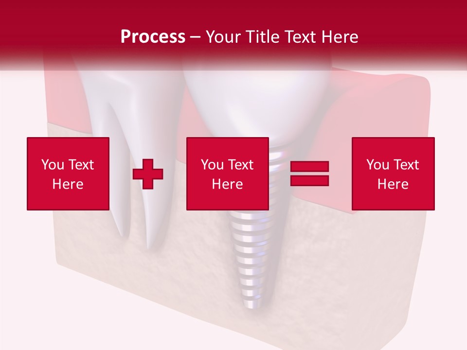 Research Technology Dentures PowerPoint Template