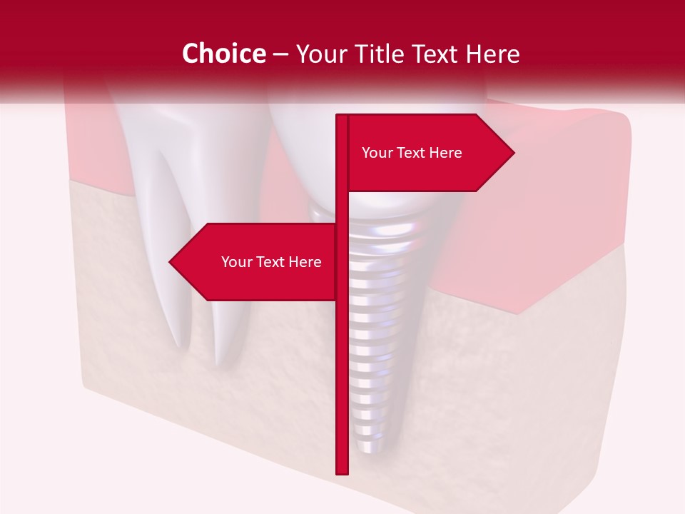 Research Technology Dentures PowerPoint Template