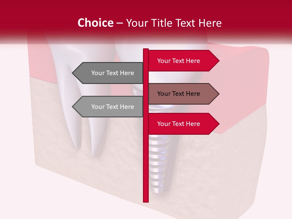 Research Technology Dentures PowerPoint Template