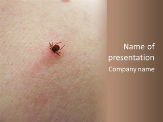 Dangerous Tick Borreliose PowerPoint Template