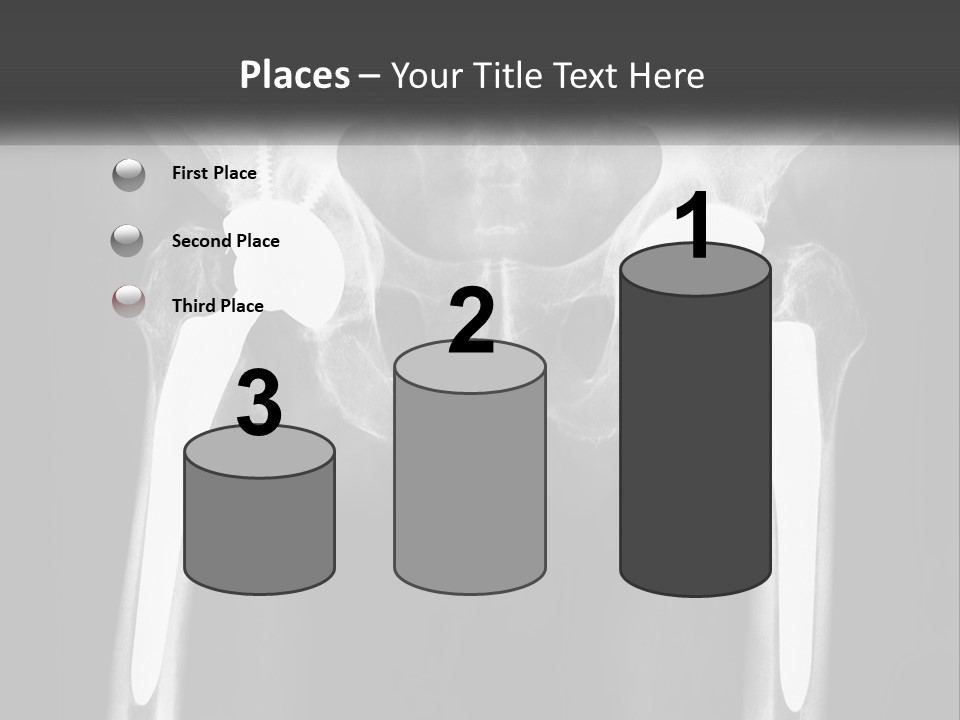 Temperature Conditioner Remote PowerPoint Template
