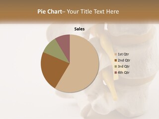 Exercise Arthroscopy Knee PowerPoint Template