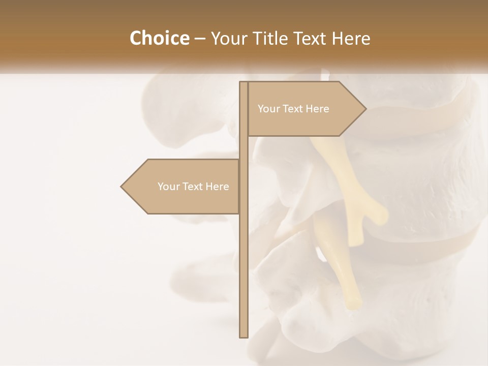 Exercise Arthroscopy Knee PowerPoint Template