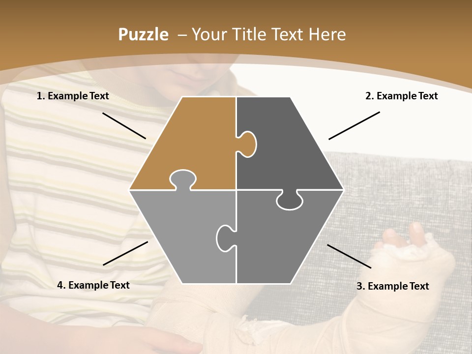 Arm Condition One PowerPoint Template