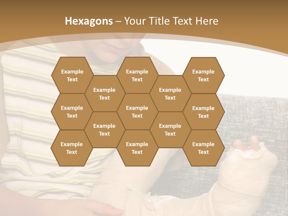 Arm Condition One PowerPoint Template