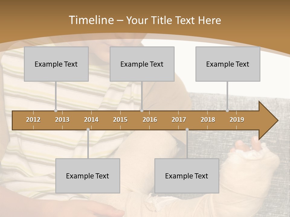 Arm Condition One PowerPoint Template