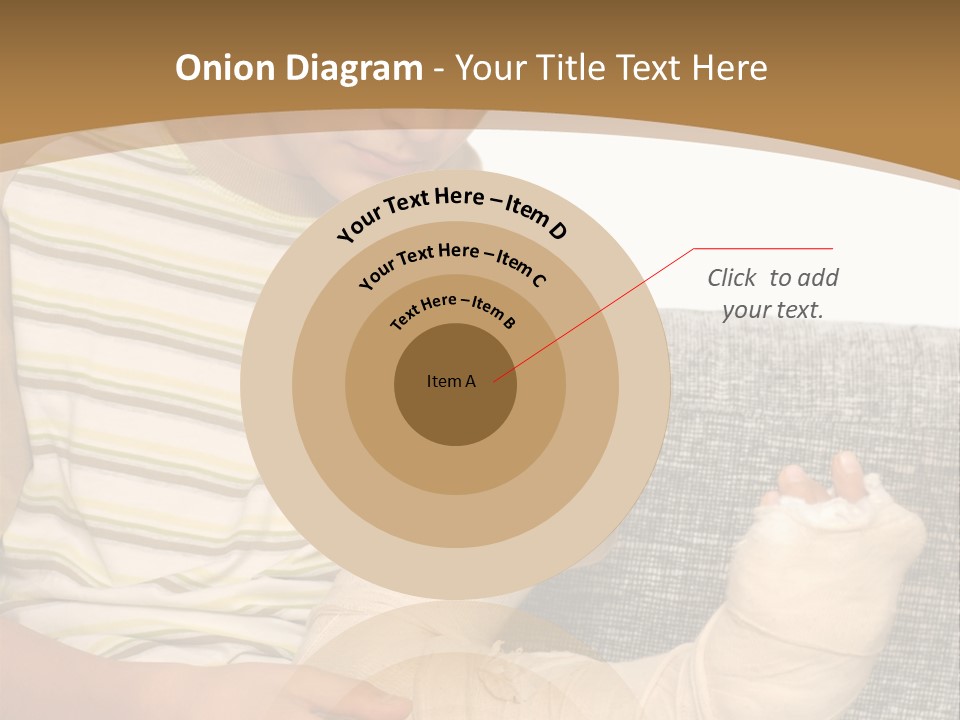 Arm Condition One PowerPoint Template