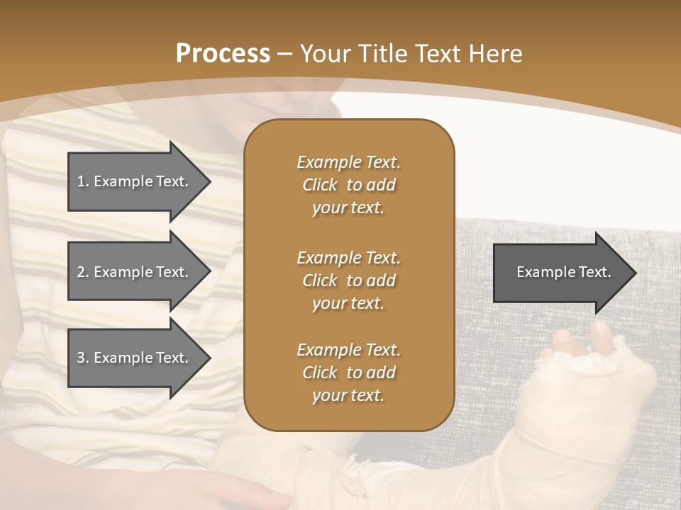 Arm Condition One PowerPoint Template