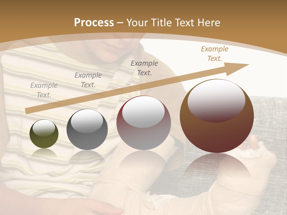 Arm Condition One PowerPoint Template