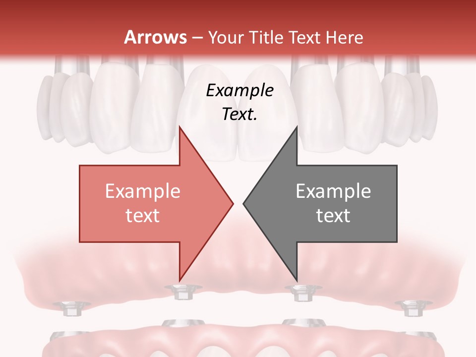 Pyorrhea Health Pain PowerPoint Template