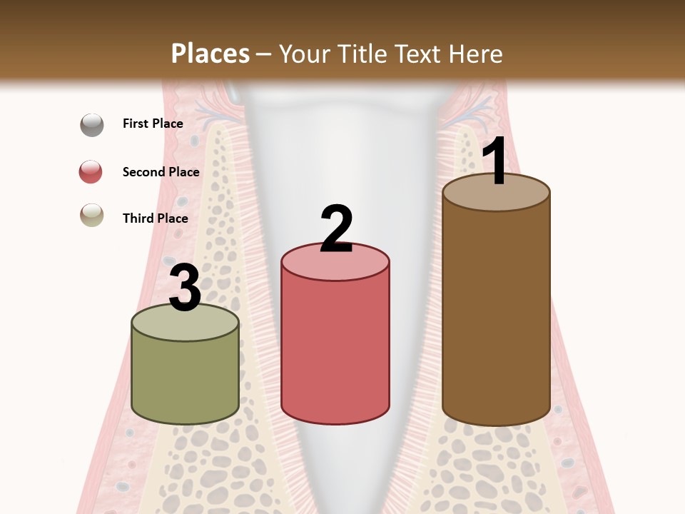 Health Plaque Infection PowerPoint Template