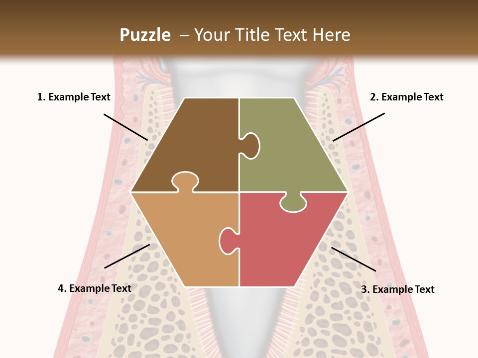 Health Plaque Infection PowerPoint Template