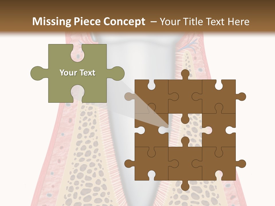 Health Plaque Infection PowerPoint Template