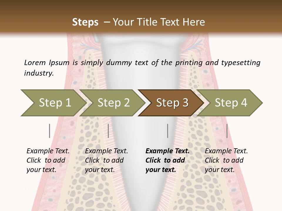 Health Plaque Infection PowerPoint Template