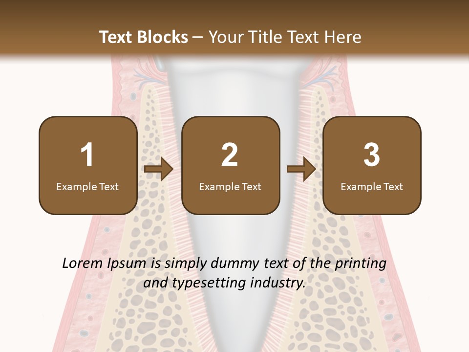Health Plaque Infection PowerPoint Template