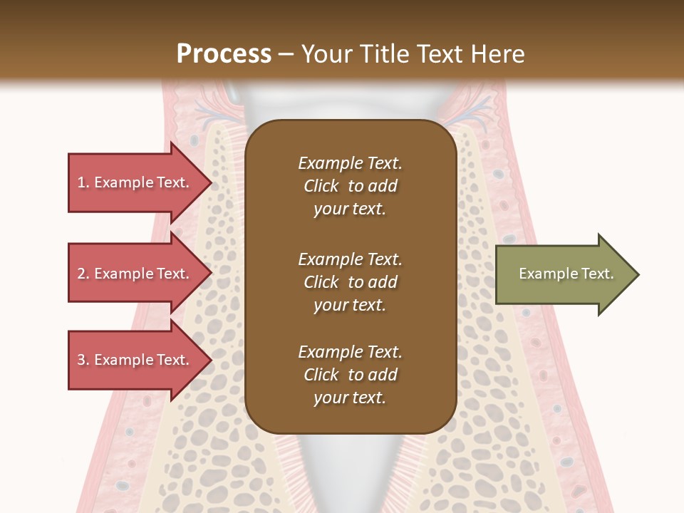 Health Plaque Infection PowerPoint Template