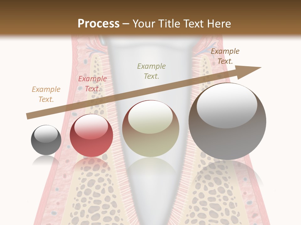 Health Plaque Infection PowerPoint Template