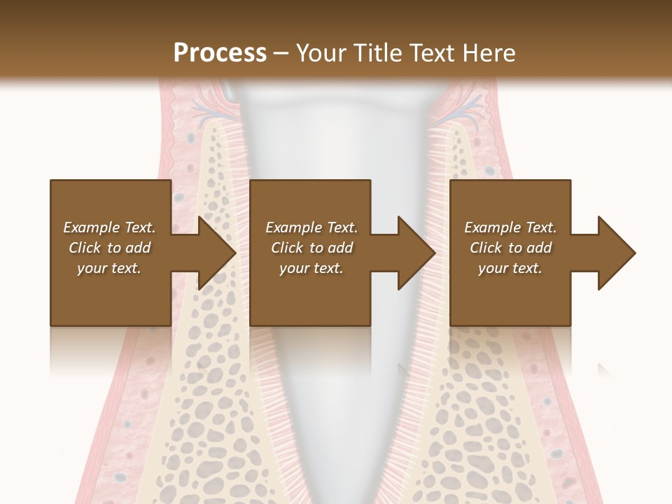 Health Plaque Infection PowerPoint Template