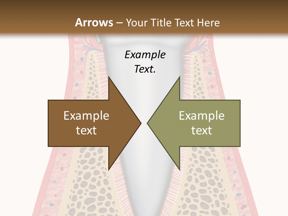 Health Plaque Infection PowerPoint Template
