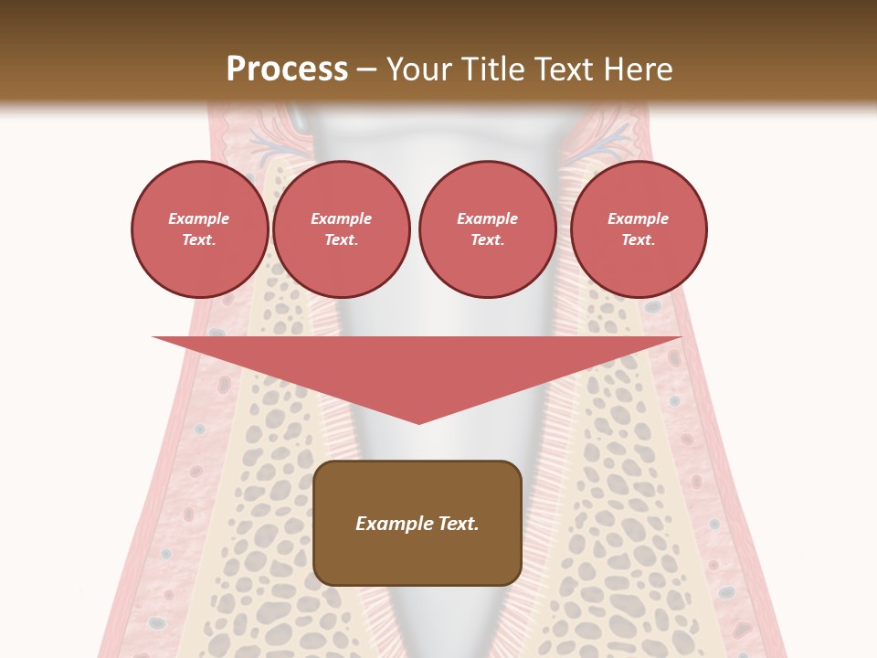 Health Plaque Infection PowerPoint Template