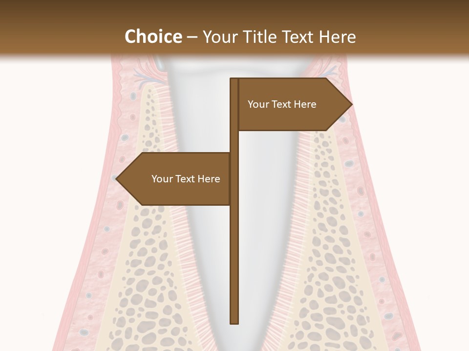 Health Plaque Infection PowerPoint Template