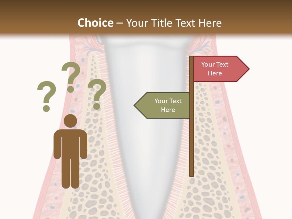 Health Plaque Infection PowerPoint Template
